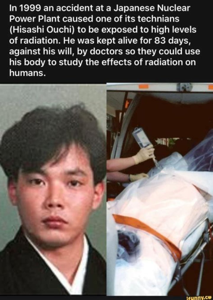 A Detailed Guide To Hisashi Ouchi's Severe Injuries: Causes And Consequences