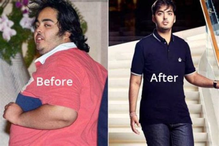 Anant Ambani's Astonishing Health Journey: A Story Of Triumph And Perseverance
