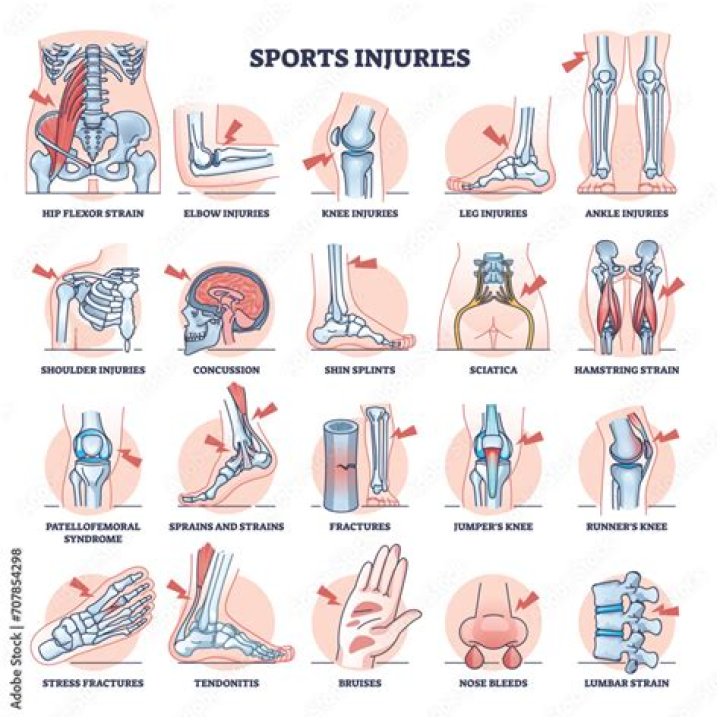Ronaldinho's Historic Injuries: A Comprehensive Overview