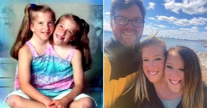 The Enduring Story Of Abby And Brittany Hensel: A Journey Of Resilience